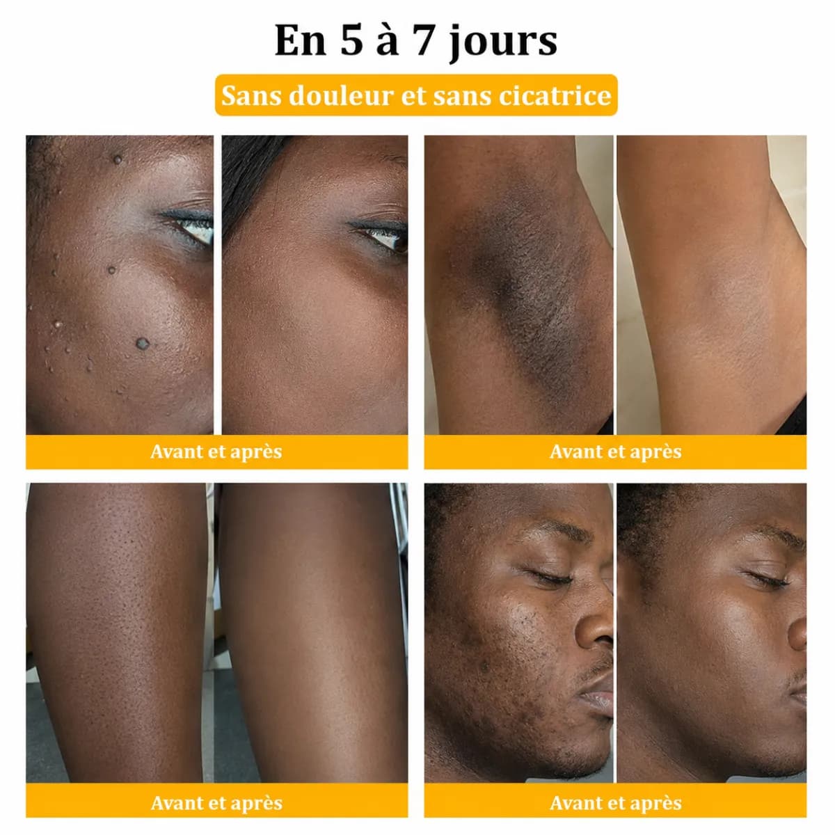 Crème BEE VENOM - Dites adieu aux rides, taches et imperfections de la peau