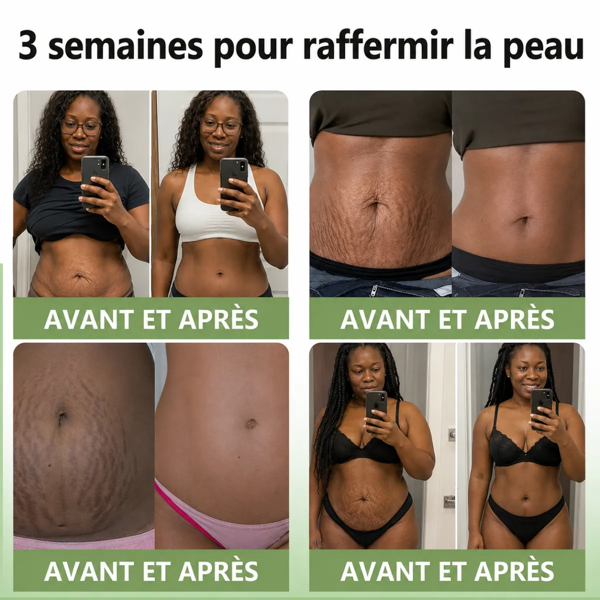 💚 Collagen Firming Cream - Retrouvez une peau plus ferme et plus jeune naturellement ✨